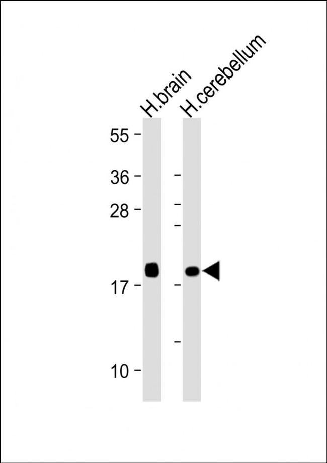 VSNL1 Antibody in Western Blot (WB)