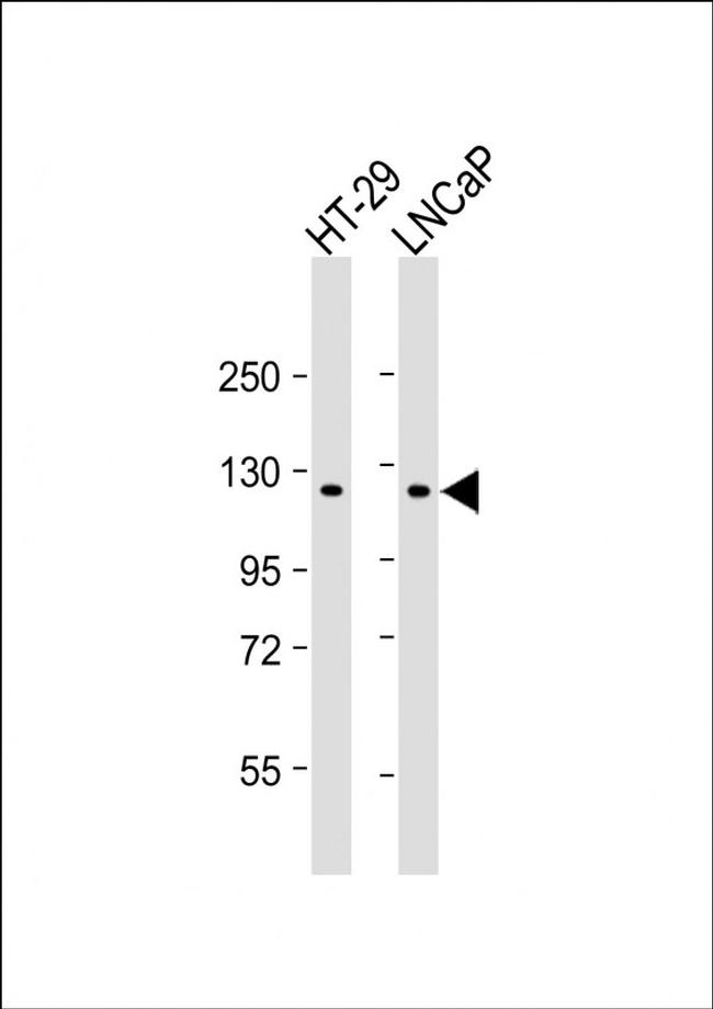SCAP Antibody in Western Blot (WB)
