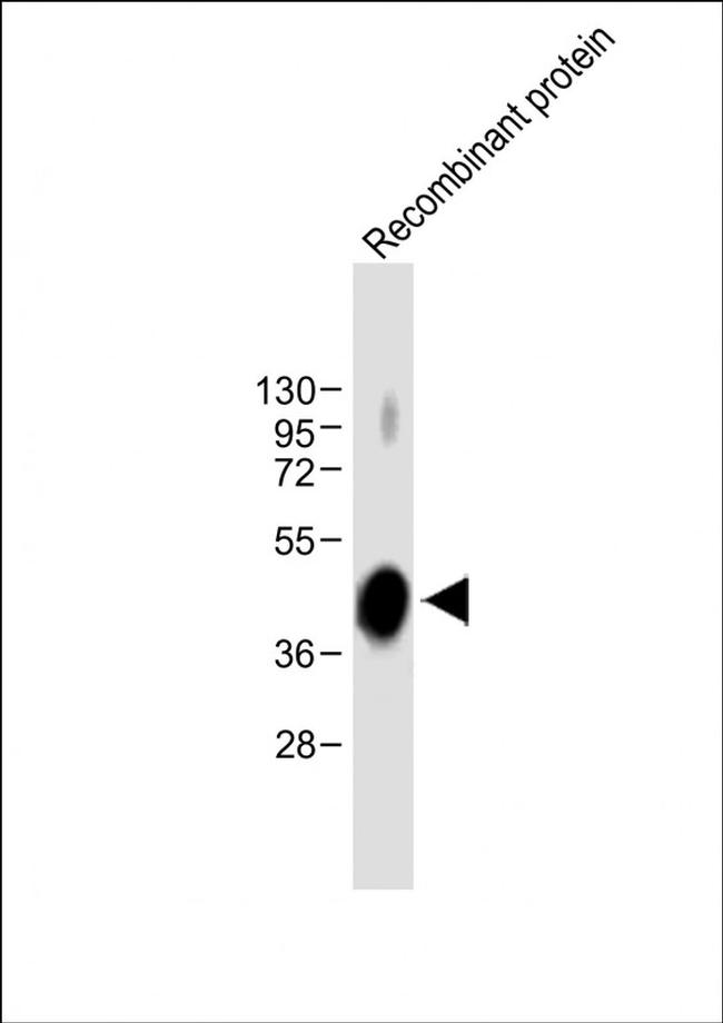 ADAMTS4 Antibody in Western Blot (WB)