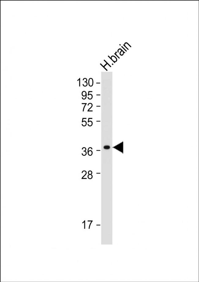 GDE1 Antibody in Western Blot (WB)