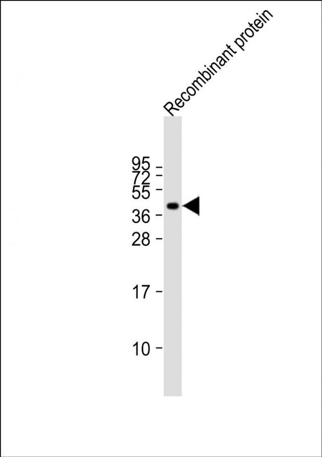 FAT4 Antibody in Western Blot (WB)