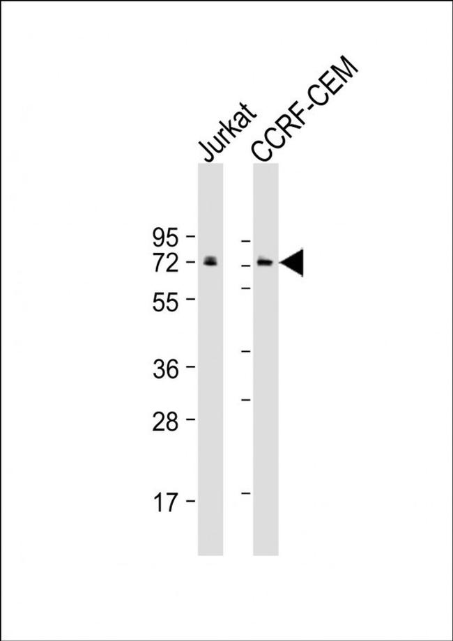 MTG16 Antibody in Western Blot (WB)