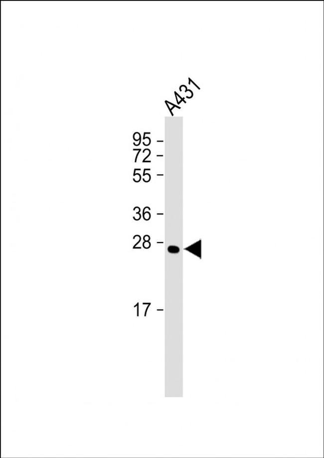 Calpain S1 Antibody in Western Blot (WB)