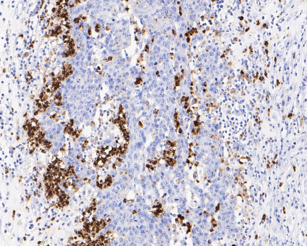 Lysozyme Antibody in Immunohistochemistry (Paraffin) (IHC (P))