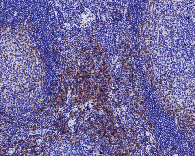 CD4 Antibody in Immunohistochemistry (Paraffin) (IHC (P))