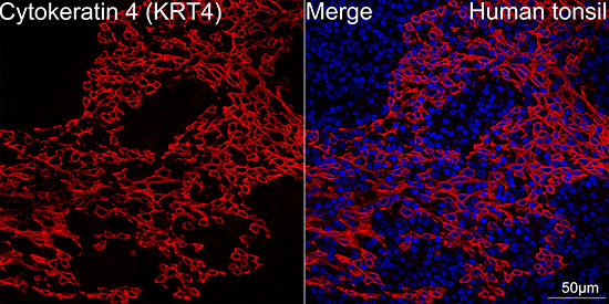 Cytokeratin 4 Antibody in Immunohistochemistry (Paraffin) (IHC (P))