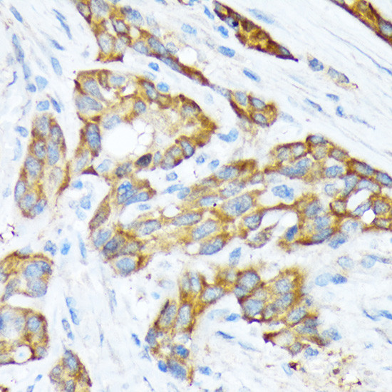 STIP1 Antibody in Immunohistochemistry (Paraffin) (IHC (P))