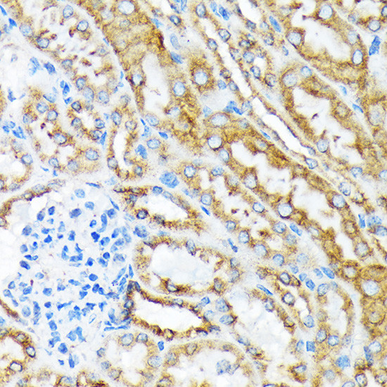 MSP Antibody in Immunohistochemistry (Paraffin) (IHC (P))