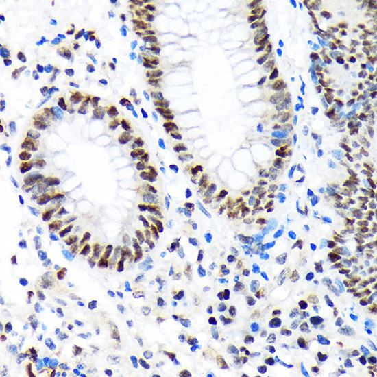 PBRM1 Antibody in Immunohistochemistry (Paraffin) (IHC (P))