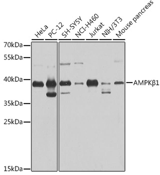 AMPK beta-1 Antibody in Western Blot (WB)