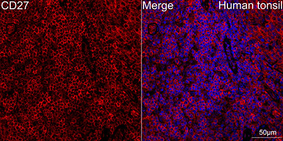 CD27 Antibody in Immunohistochemistry (Paraffin) (IHC (P))