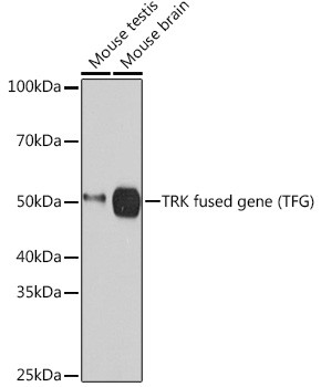 TRK fused gene Antibody in Western Blot (WB)