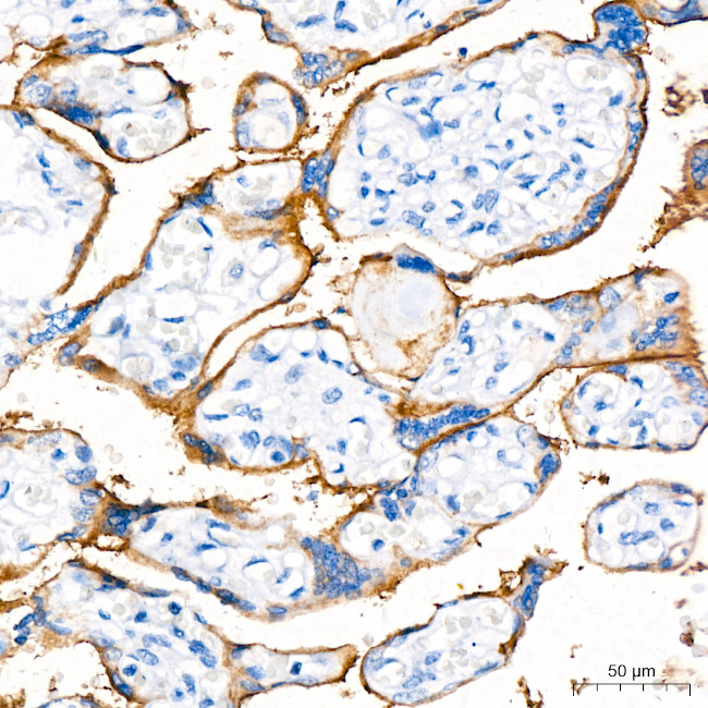PD-L1 (CD274) Antibody in Immunohistochemistry (Paraffin) (IHC (P))