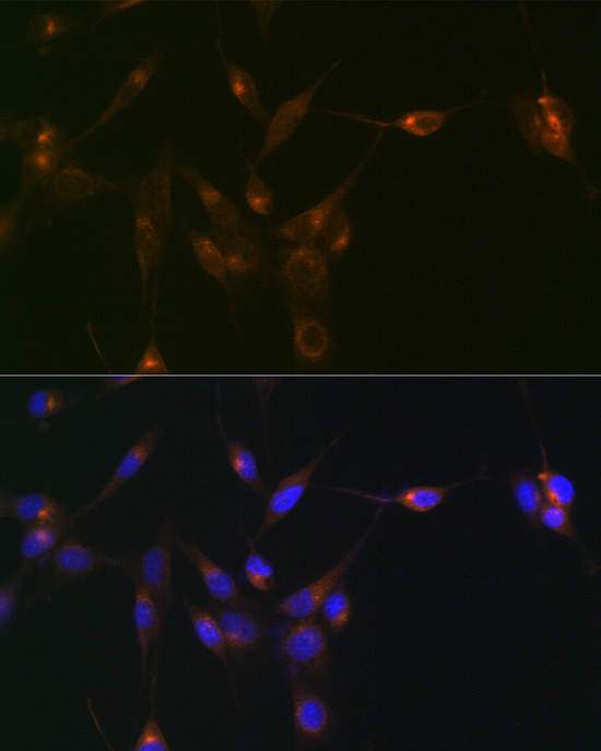 PDLIM1 Antibody in Immunocytochemistry (ICC/IF)