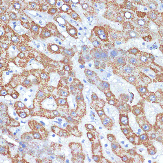 HMGCS2 Antibody in Immunohistochemistry (Paraffin) (IHC (P))