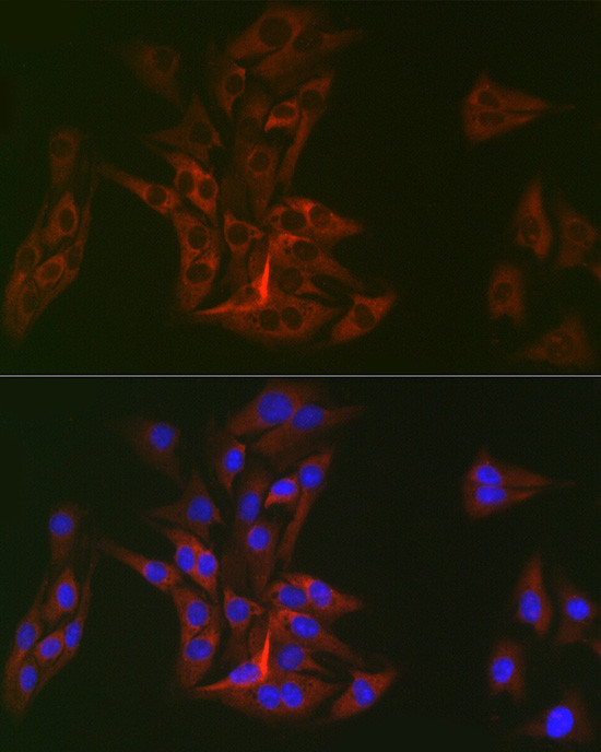 DOK1 Antibody in Immunocytochemistry (ICC/IF)