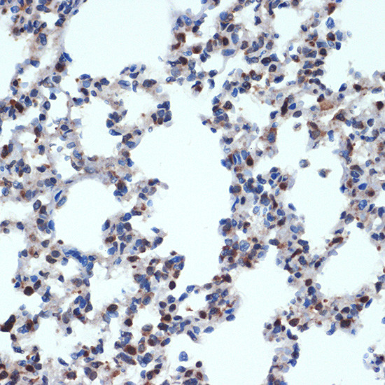 Gemin 2 Antibody in Immunohistochemistry (Paraffin) (IHC (P))