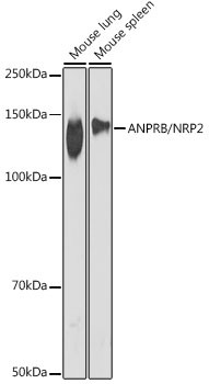 Npr2 Antibody in Western Blot (WB)