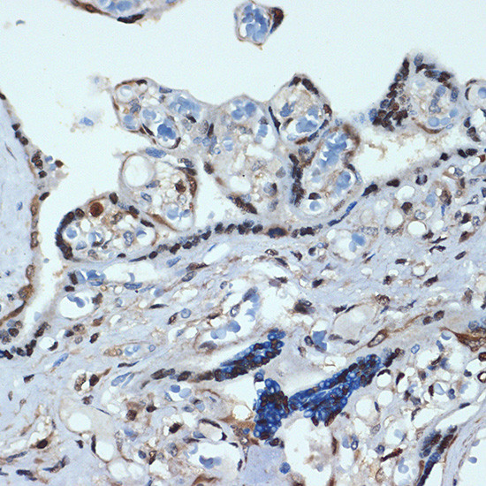 HOXA9 Antibody in Immunohistochemistry (Paraffin) (IHC (P))