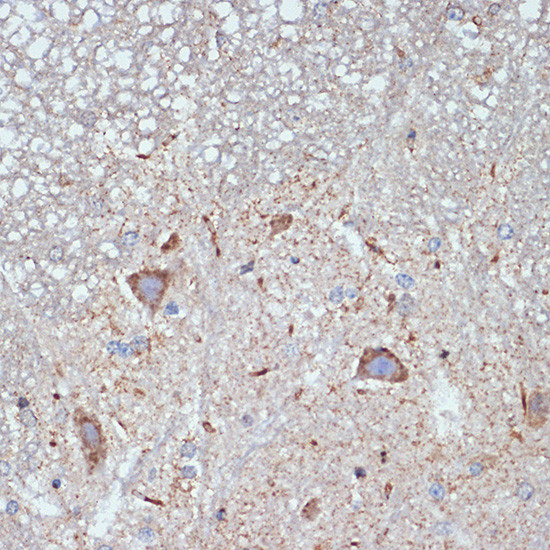 CBR1 Antibody in Immunohistochemistry (Paraffin) (IHC (P))