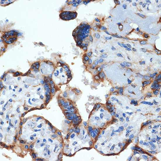 NLK Antibody in Immunohistochemistry (Paraffin) (IHC (P))