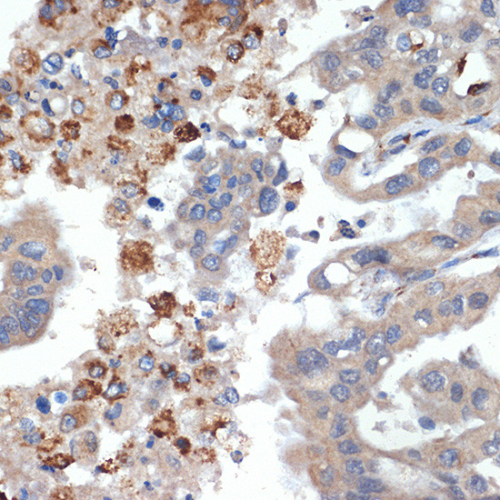 Trypsin 2 Antibody in Immunohistochemistry (Paraffin) (IHC (P))