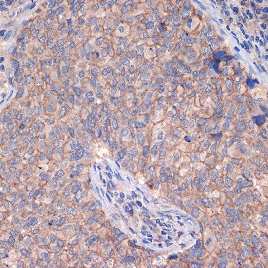 CTNNA3 Antibody in Immunohistochemistry (Paraffin) (IHC (P))