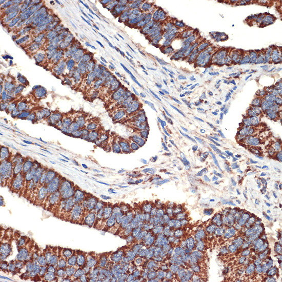 BCL2L14 Antibody in Immunohistochemistry (Paraffin) (IHC (P))