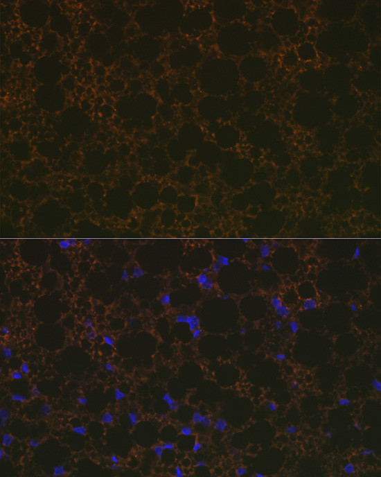 UCP1/UCP3 Antibody in Immunocytochemistry (ICC/IF)