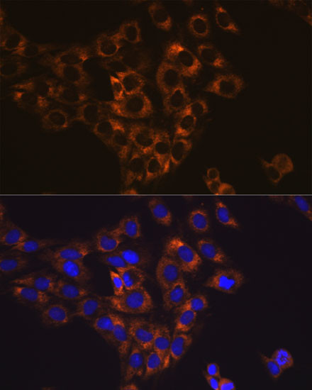 Caspase 6 Antibody in Immunocytochemistry (ICC/IF)