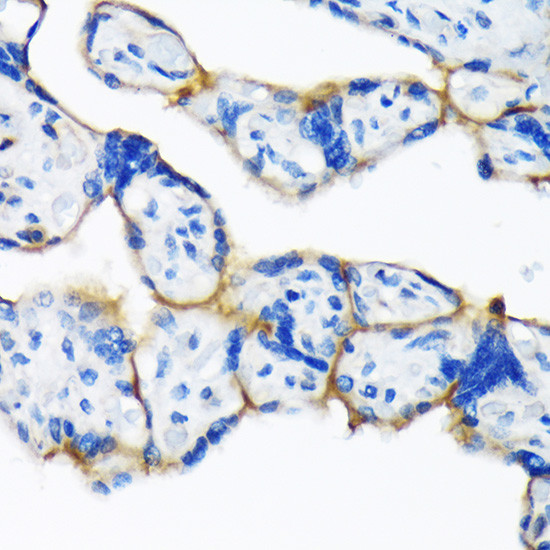 Dysferlin Antibody in Immunohistochemistry (Paraffin) (IHC (P))