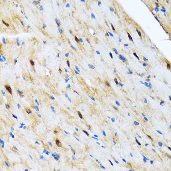 COPS3 Antibody in Immunohistochemistry (Paraffin) (IHC (P))