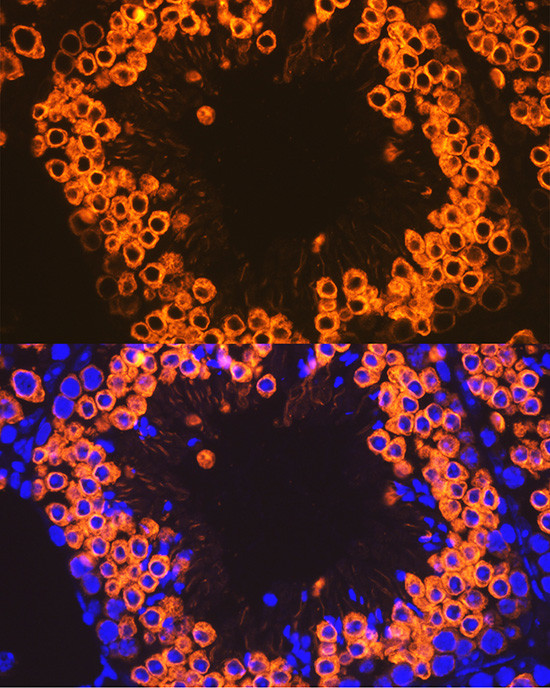 CLGN Antibody in Immunohistochemistry (Paraffin) (IHC (P))