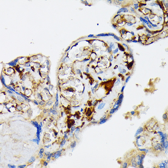 Fibrinogen alpha chain Antibody in Immunohistochemistry (Paraffin) (IHC (P))
