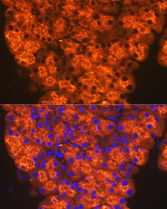 CTRL Antibody in Immunocytochemistry (ICC/IF)