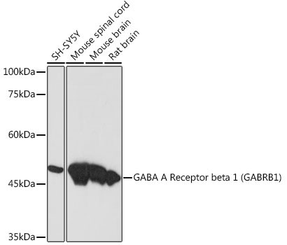 GABRB1 Antibody in Western Blot (WB)