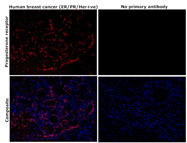 Progesterone Receptor Antibody in Immunohistochemistry (Paraffin) (IHC (P))