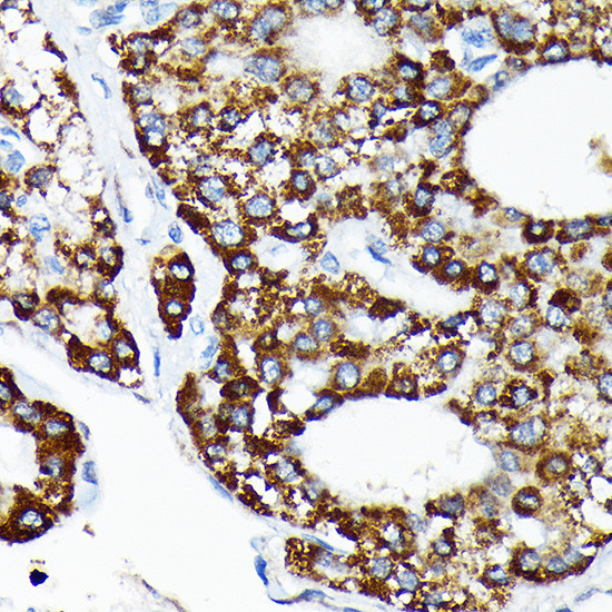 HSPA4 Antibody in Immunohistochemistry (Paraffin) (IHC (P))