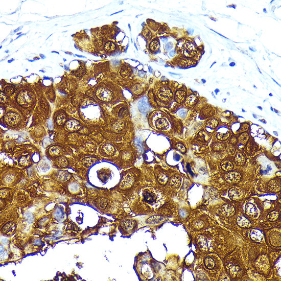 Mammaglobin A Antibody in Immunohistochemistry (Paraffin) (IHC (P))