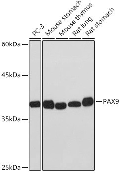 PAX9 Antibody in Western Blot (WB)