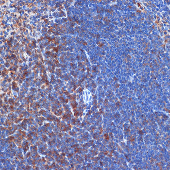 PIK3CD Antibody in Immunohistochemistry (Paraffin) (IHC (P))