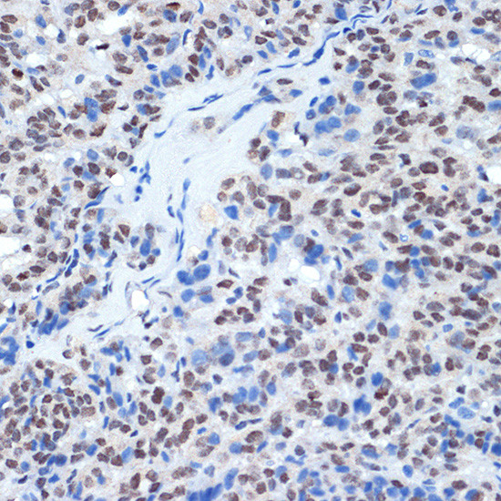 RING1 Antibody in Immunohistochemistry (Paraffin) (IHC (P))
