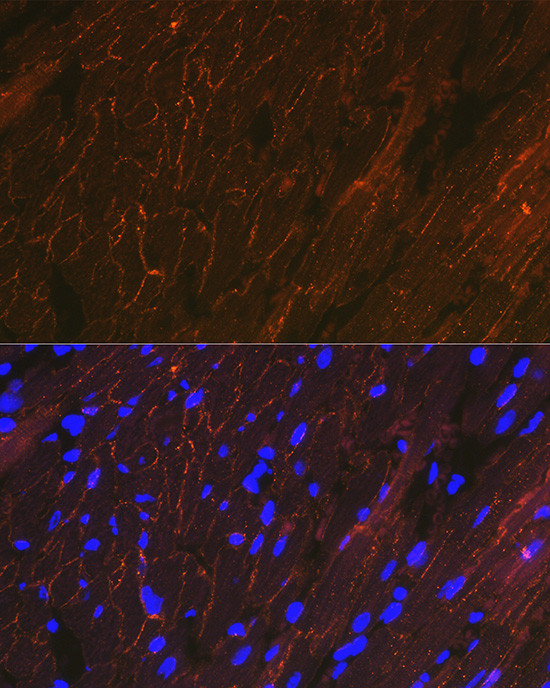 Alpha Sarcoglycan Antibody in Immunocytochemistry (ICC/IF)