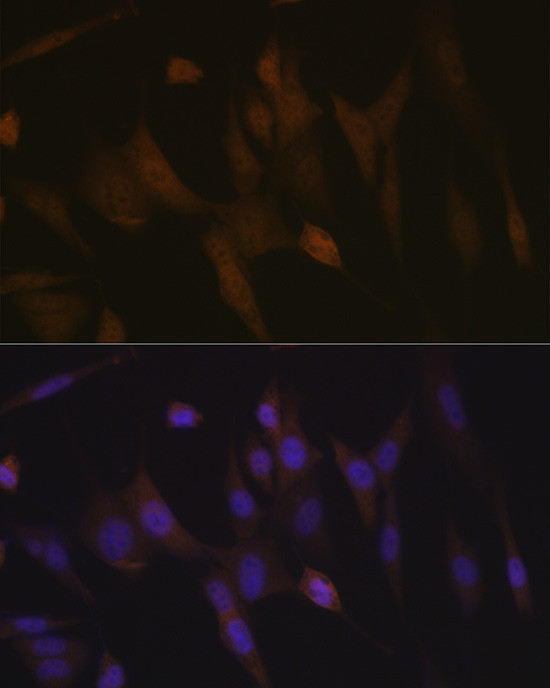 TNPO3 Antibody in Immunocytochemistry (ICC/IF)