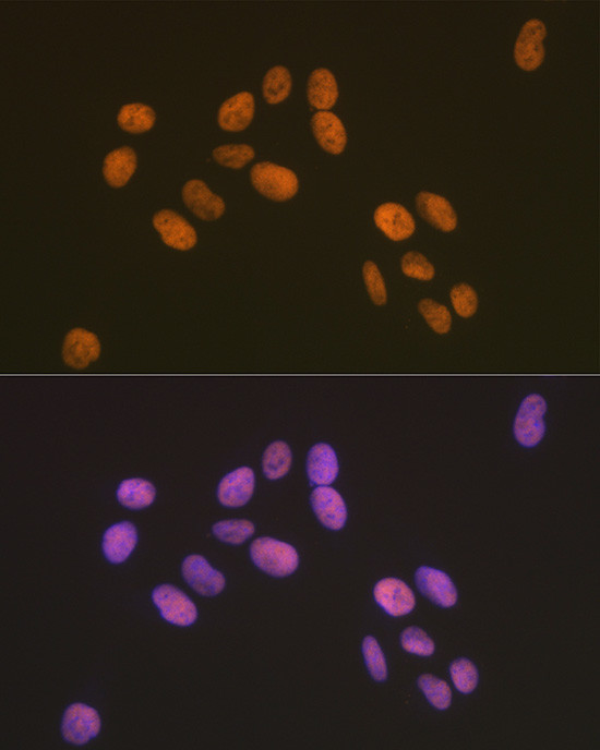 Pokemon Antibody in Immunocytochemistry (ICC/IF)