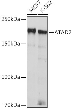 ATAD2 Antibody in Western Blot (WB)