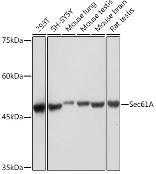 SEC61alpha Antibody in Western Blot (WB)