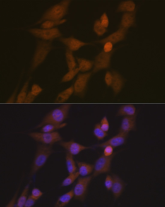 STK33 Antibody in Immunocytochemistry (ICC/IF)