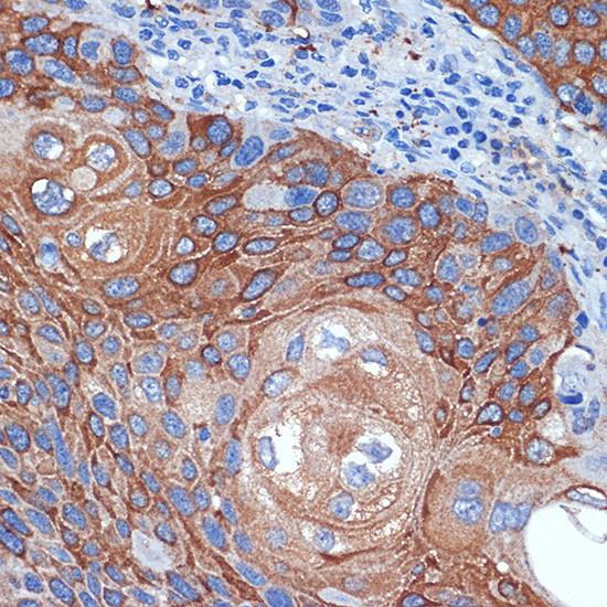 BCL2L12 Antibody in Immunohistochemistry (Paraffin) (IHC (P))