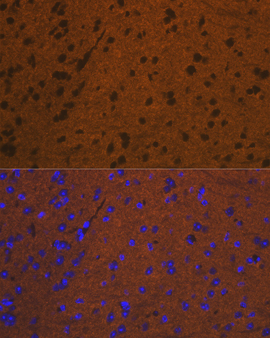 Syntaxin 1 Antibody in Immunocytochemistry (ICC/IF)